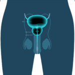 Enlarged prostate diagram